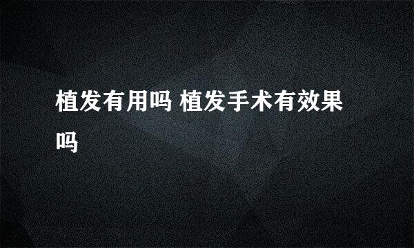 植发有用吗 植发手术有效果吗