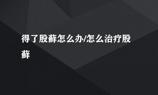 得了股藓怎么办/怎么治疗股藓