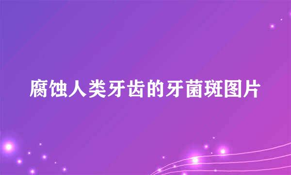 腐蚀人类牙齿的牙菌斑图片
