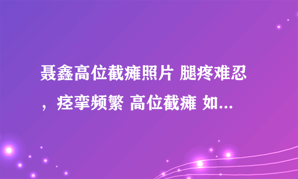 聂鑫高位截瘫照片 腿疼难忍，痉挛频繁 高位截瘫 如何解除高位截瘫后腿痛和痉挛？