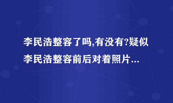 李民浩整容了吗,有没有?疑似李民浩整容前后对着照片曝光（组图）