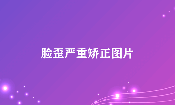 脸歪严重矫正图片